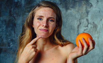 Alimente care pot agrava acneea și cum să le eviți Alimente care pot agrava acneea și cum să le eviți